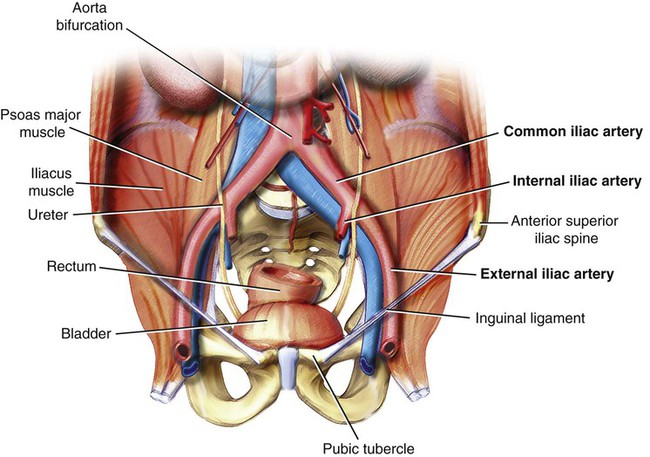 Anatomical location of the internal iliac artery (source)
