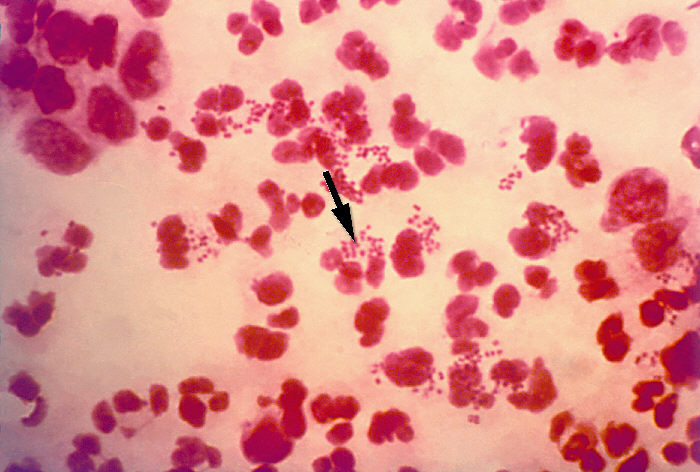 Gram stain of N. gonorrhoeae (source) 