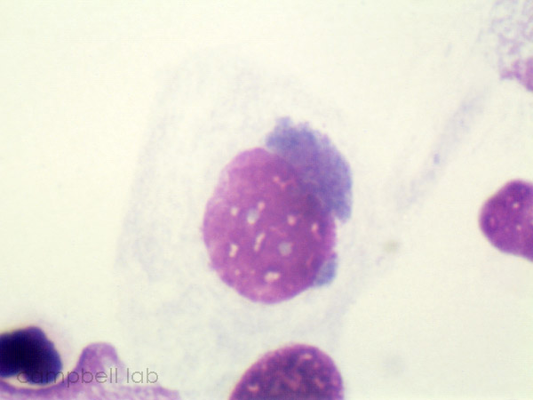 Chlamydial inclusion bodies can be intracellular with a Giemsa stain (source) 