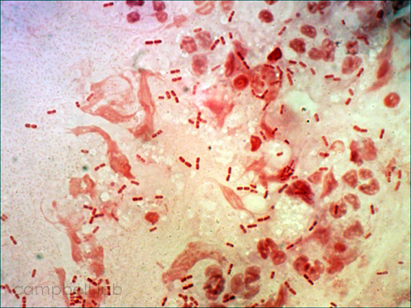 Gram stain of HIB (source)