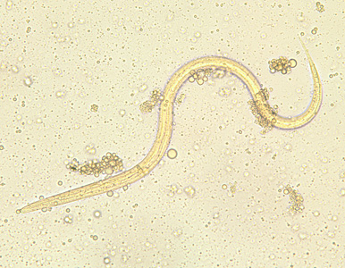 Larvae of ss seen on an unstained wet mount (source)