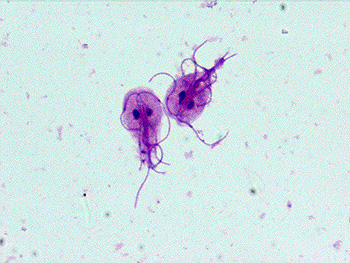 Visual appearance of Giardia lamblia on microscopy (source) 