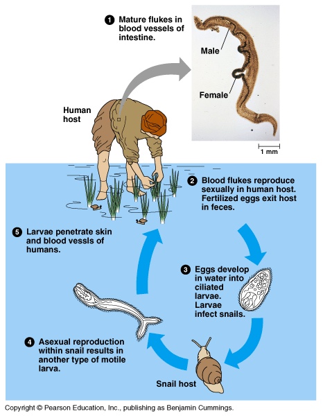 Schistosomiasis usmle, Ovarian cancer jelly belly, Viermele castelului, Schistosomiasis usmle