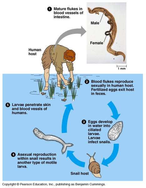 schistosomiasis usmle)