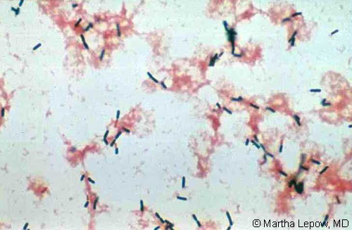 Gram stain of Listeria (source)