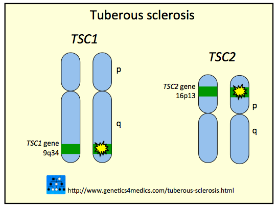 The genetic basis of tuberose sclerosis involves either the TSC1 or TSC2 gene (source) 