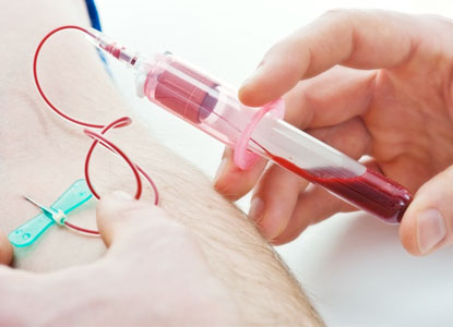 Grouping tests that utilize venous blood together can maximize efficiency and minimize the need to re-access the patient (source)