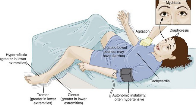 Presenting signs and symptoms of NMS (source)