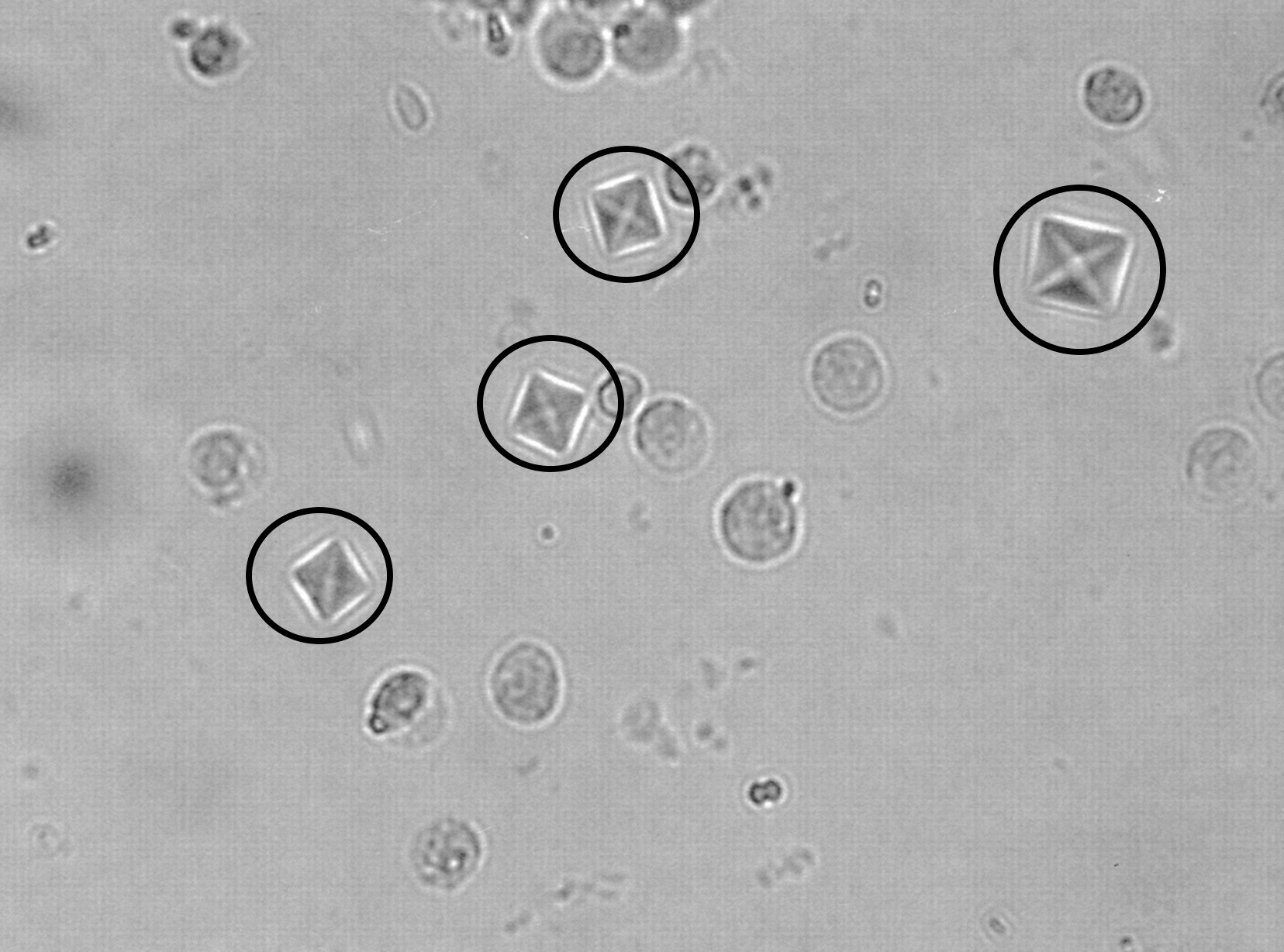 Visual appearance of calcium oxalate crystals in a urine sample (source) 