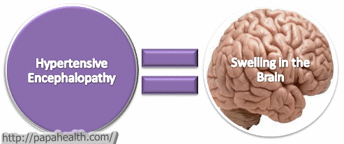 Amidst all the terminology it is important to remember what hypertensive encephalopathy ACTUALLY is (source).