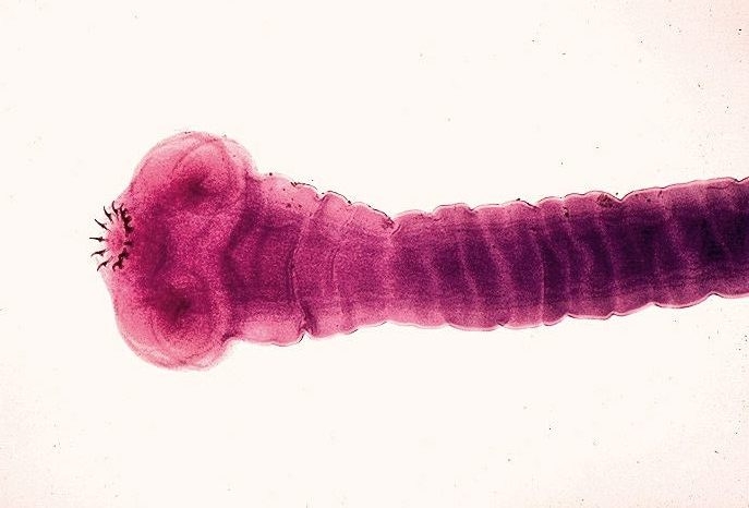 Visual appearance of the Taneia solium tapeworm (source)