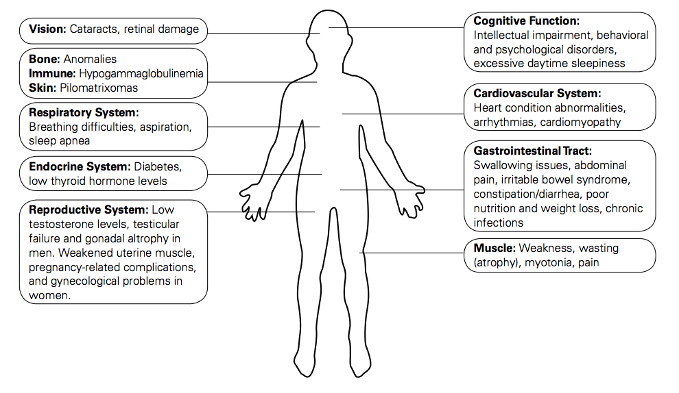 Myotonic dystrophy is a multi-system disease that has a wide range of different symptoms (source)