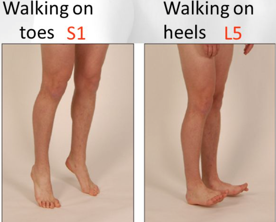 Testing heel/toe walking can detect issues with the L5/S1 nerve roots respectively (source)