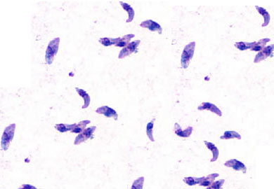 Visual appearance of Toxoplasma gondii under light microscopy (source)
