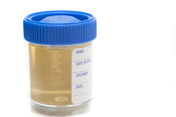 While the data from a urine osmolality study/ urine spot sodium check will be used later in our workup, it is important to order these studies initially as the patient presents with hyponatremia (source)