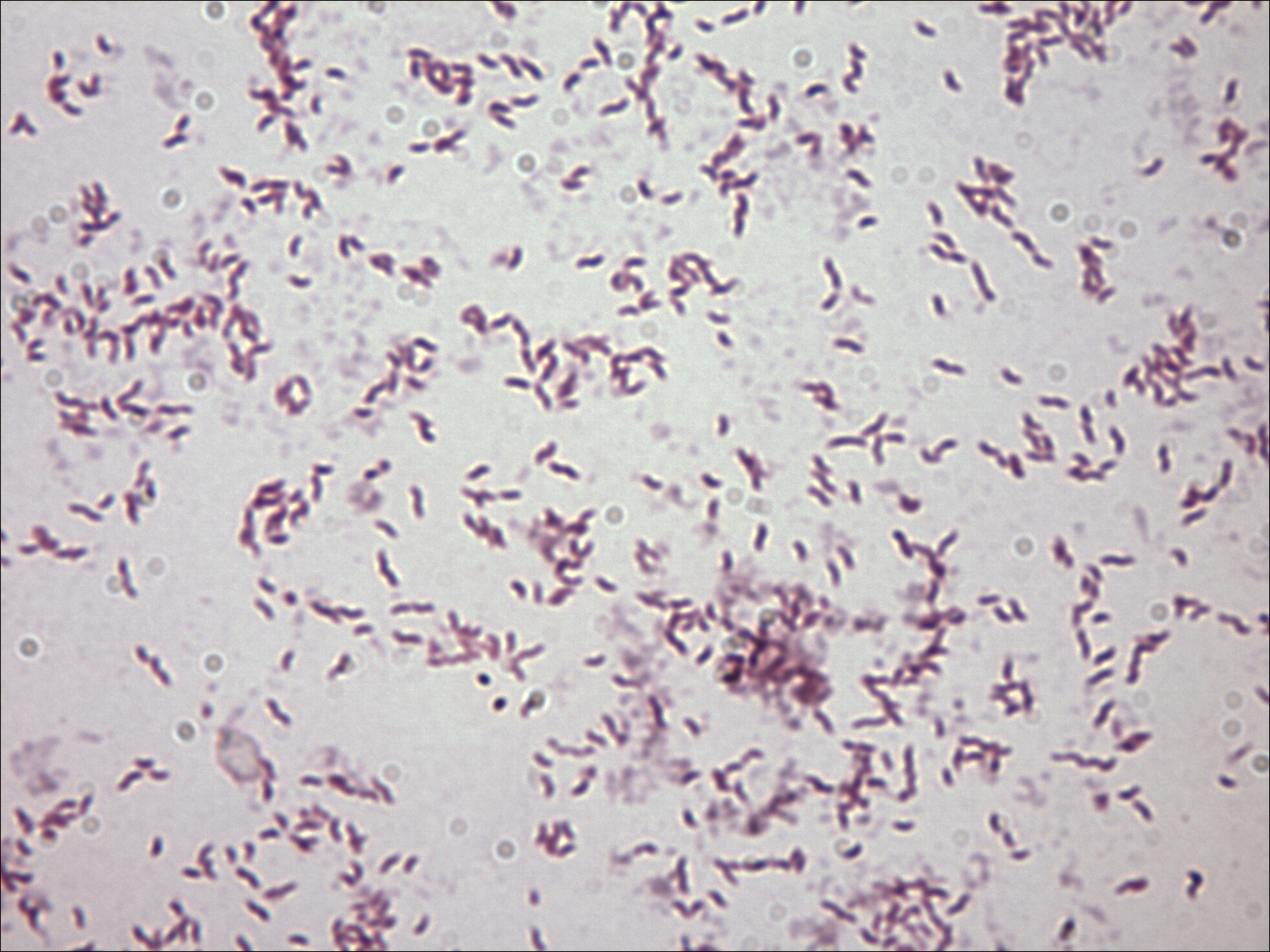 Gram stain of Campylobacter jejuni (source)