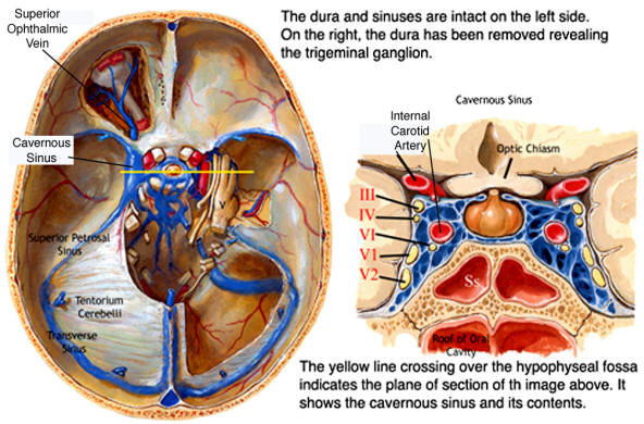 As the name suggests, CST involves the cavernous sinus (source) 
