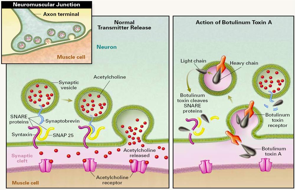 The botulinum toxin will prevent the release of the important stimulatory neurotransmitter acetylcholine (source) 