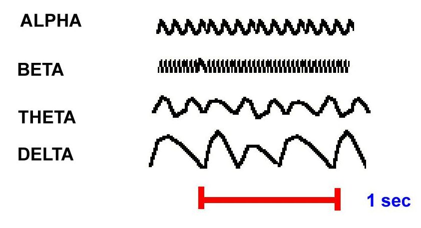 Different types of brain waves reported on the EEG represent different states of brain activity (source)