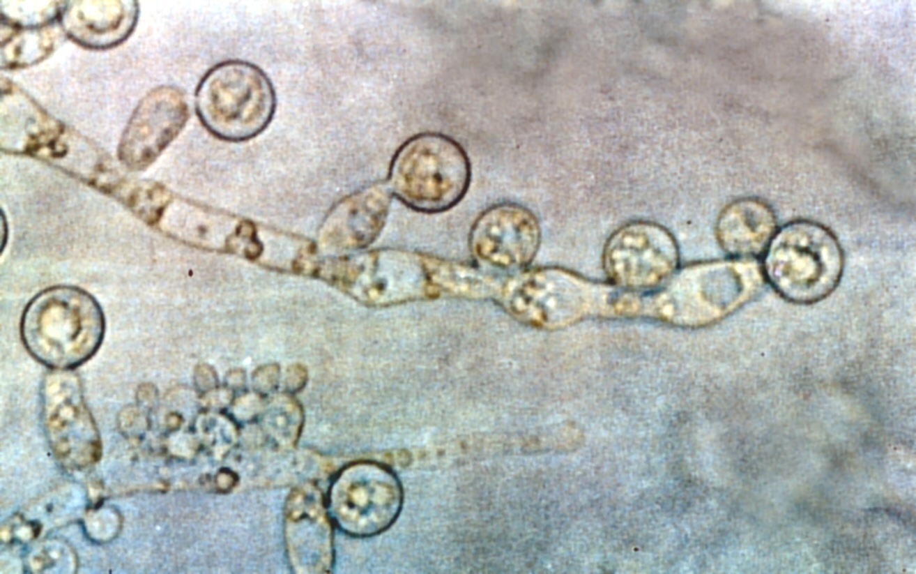The yeast organism Candida albicans is responsible for the vast majority of yeast infections (source)