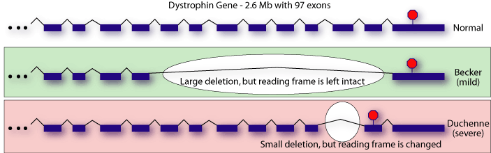 DMD is caused by a deletion in the dystrophin gene that changes the reading frame of the transcript (source) 