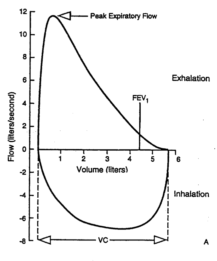 The graph represents a classic example of a flow volume loop (source)