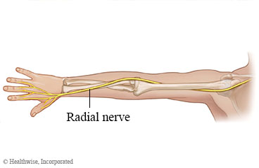 General path of the radial nerve in the arm (source) 