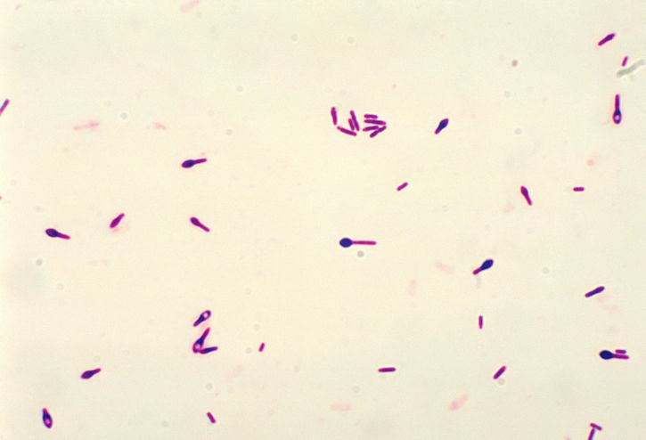 Gram stain of Clostridium botulinum (source)