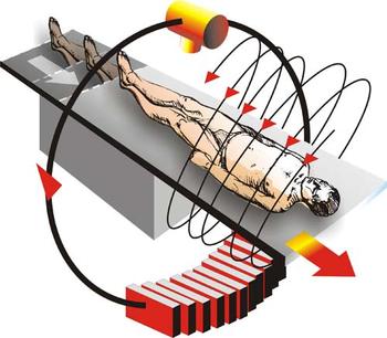 There are many moving parts to a CT scan. As the patient move thorough the machine the X-ray source spirals around the patient (rendering the 3-D image, source)