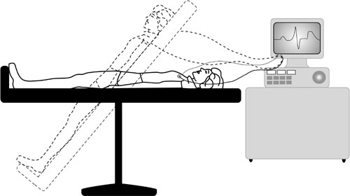 Tilt table testing is used to detect if positional changes/orthostatic stress can cause hypotension/syncope (source)