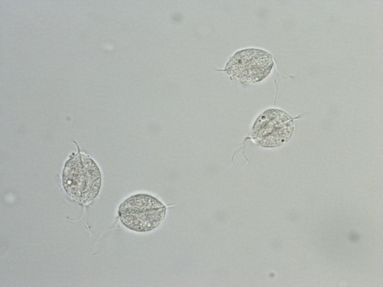 Appearance of Trichomonas vaginalis on a wet prep (source)