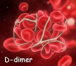 A simple D-dimer study in the case above sets off a series of events that land the patient a diagnosis of PE (source)