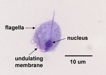 Microscopic appearance of Trichomonas 