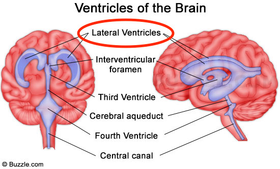 The lateral ventricles are an important structure within the brain. It is important to recognize them across radiological studies (source)