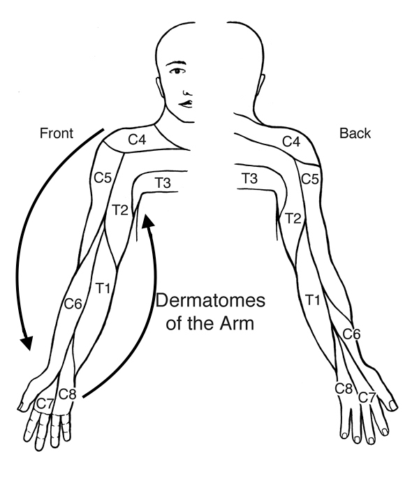 By pretending that the arm is an elongated clock face, we see that the dermatomes go from C4 to T3 (in order) in a counter clockwise pattern (when viewing the patient from the front). This pattern is preserved, but reversed when viewing the patient from the back (source).