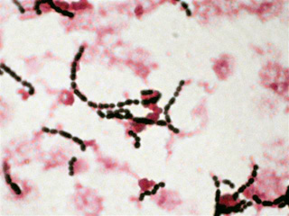 Gram stain of Streptococcus agalactiae (source)