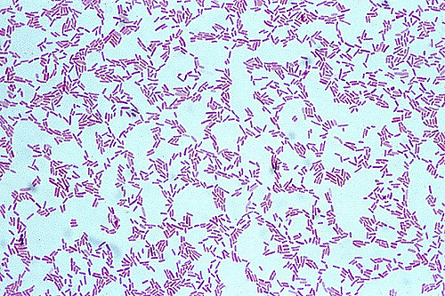 Gram stain of Pseudomonas aeurgunosa showing gram negative rods (source)