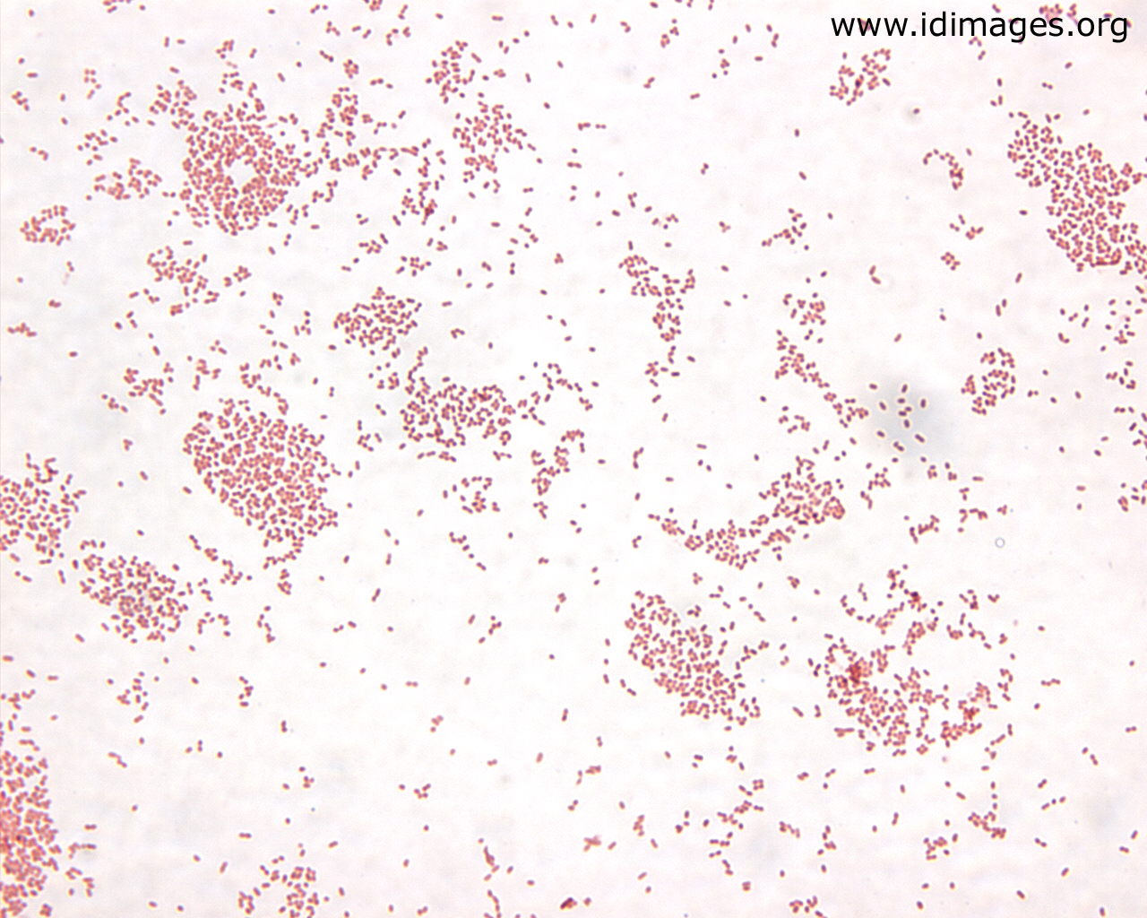 Gram stain of Bordetella pertussis (source)