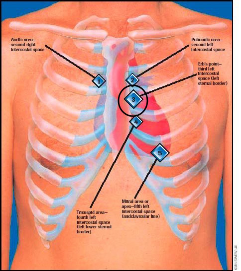 Guide To Heart Murmurs Aortic Regurgitation Murmur Aortic 