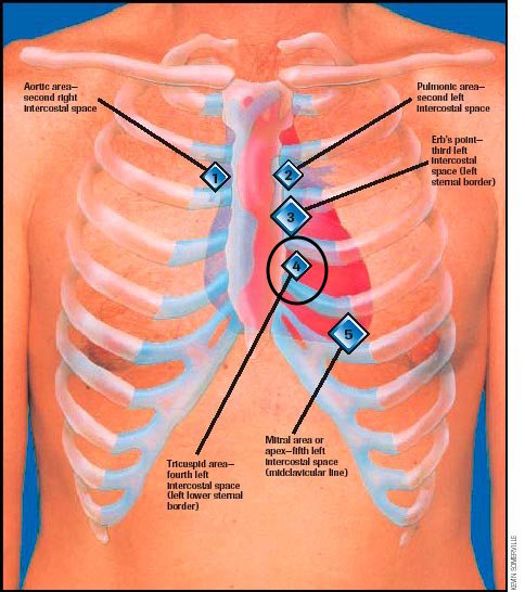 Guide To Heart Murmurs Tricuspid Regurgitation Murmur Stepwards