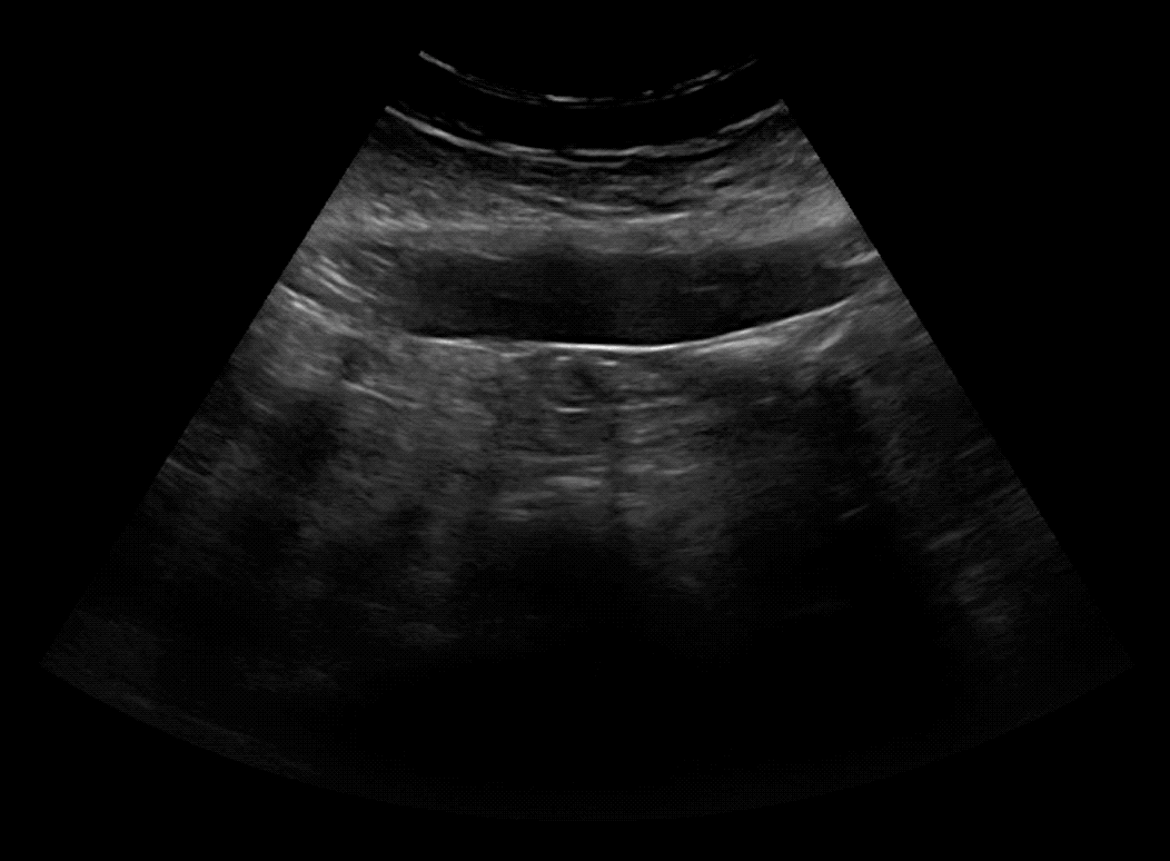 Protocoling Imaging Studies: Complete Abdominal Ultrasound (Ultrasound