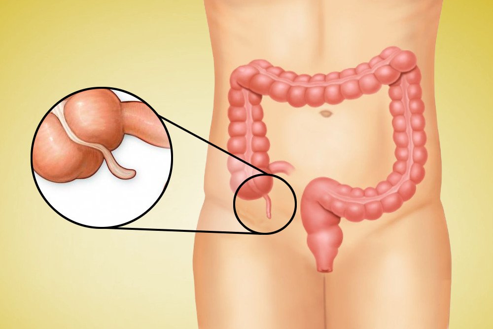 appendix