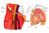 Femoral Nerve - Stepwards