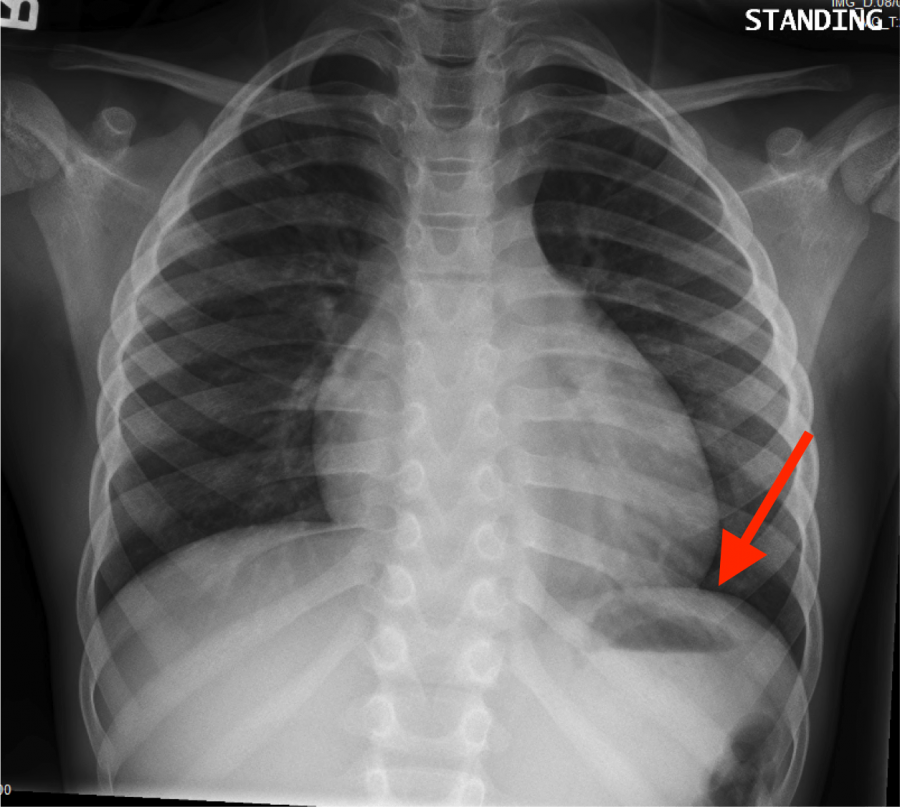 radiological-anatomy-stomach-stepwards