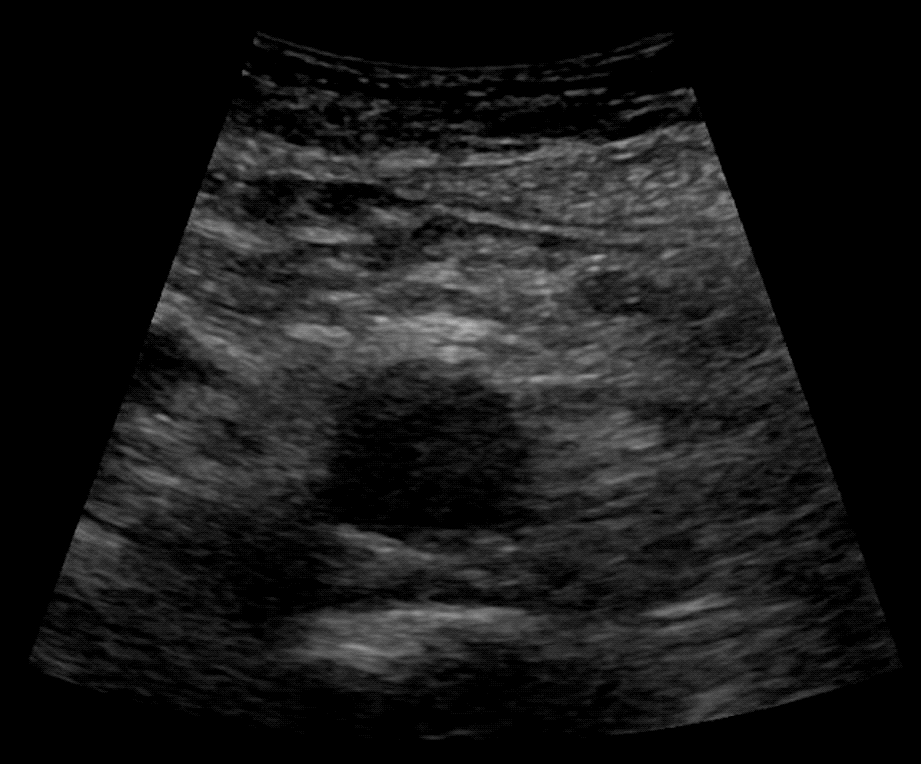 Protocoling Imaging Studies: Complete Abdominal Ultrasound (Ultrasound