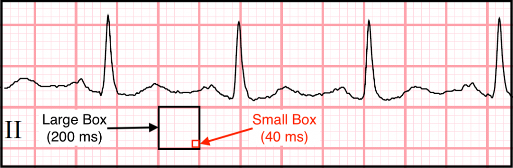 Electrocardiograms EKGs ECGs Determining The Heart Rate Stepwards
